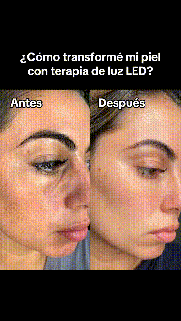 Máscara de Rejuvenecimiento Facial LED